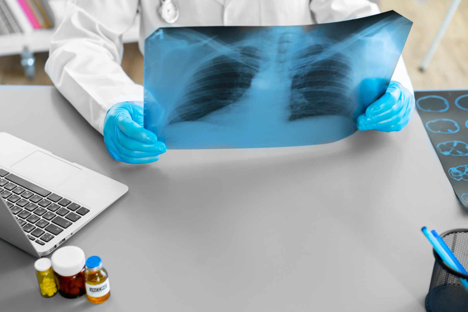 Doctor examining lungs x-ray scan in his office in hospital