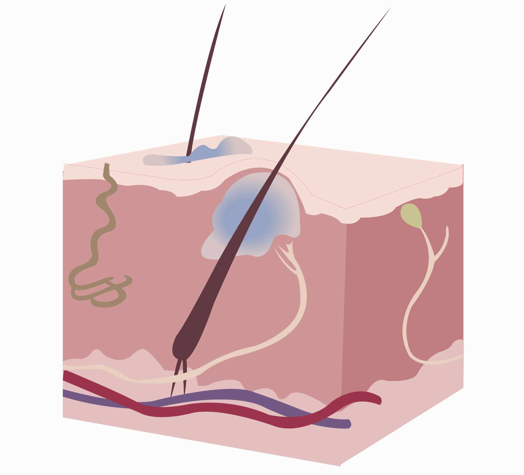 Skin-Boil-Abscess-Concept